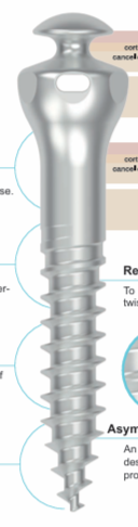 Buccal shelf screw